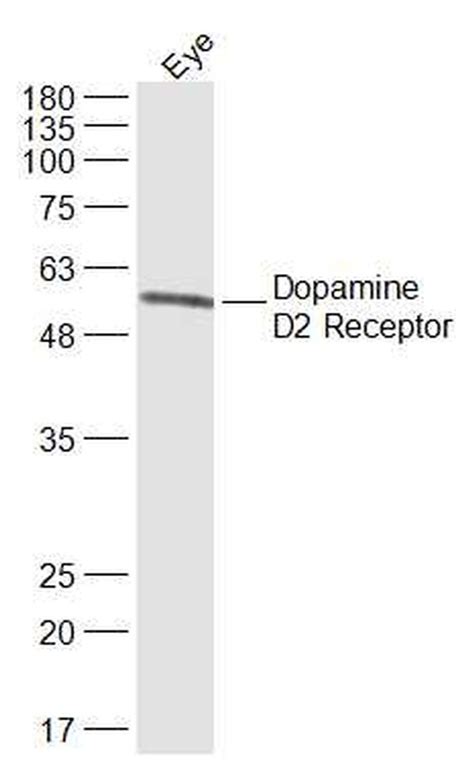 d2 receptor antibody